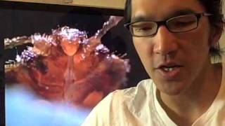 Shoe's Blues - Bedbugs!  Pt 1