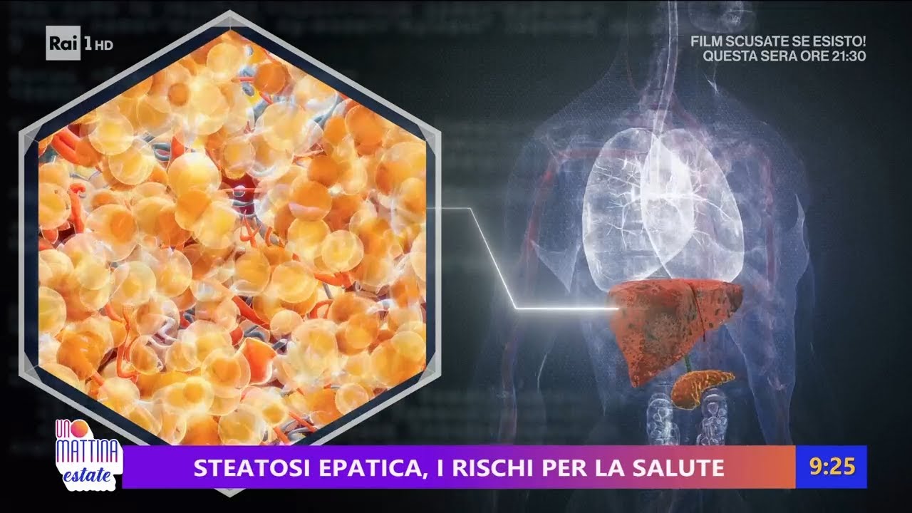 Fegato grasso - Unomattina estate 31/07/2025