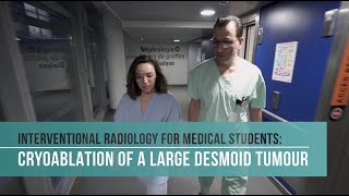 Cryoablation of a large desmoid tumour