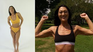26-Year-Old Woman With Wrinkling Skin Condition Wants a Career in Modeling