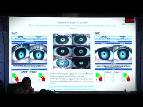 👁️ AIOC 2026 | Current Concepts in Dry Eye SyndromeDry Eye Syndrome sirf aankhon 