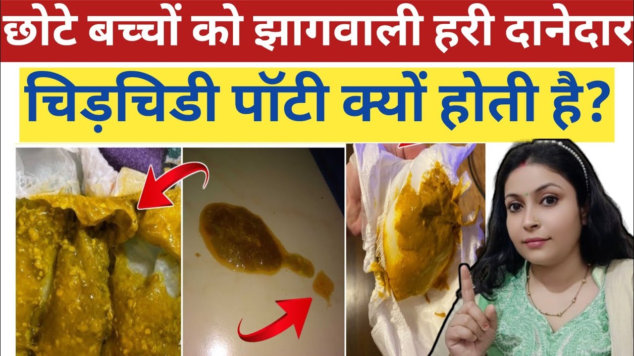 Bache ki Potty Me Jhaag Aana|| Jhag Wali Potty In Baby. बच्चे की पॉटी में झाग आना।