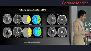 Metabolic Imaging in Stroke: UCSF Experience – Prof. Kambiz Nael