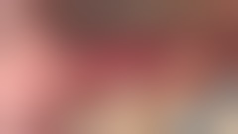 Emdogain for Recession Defects