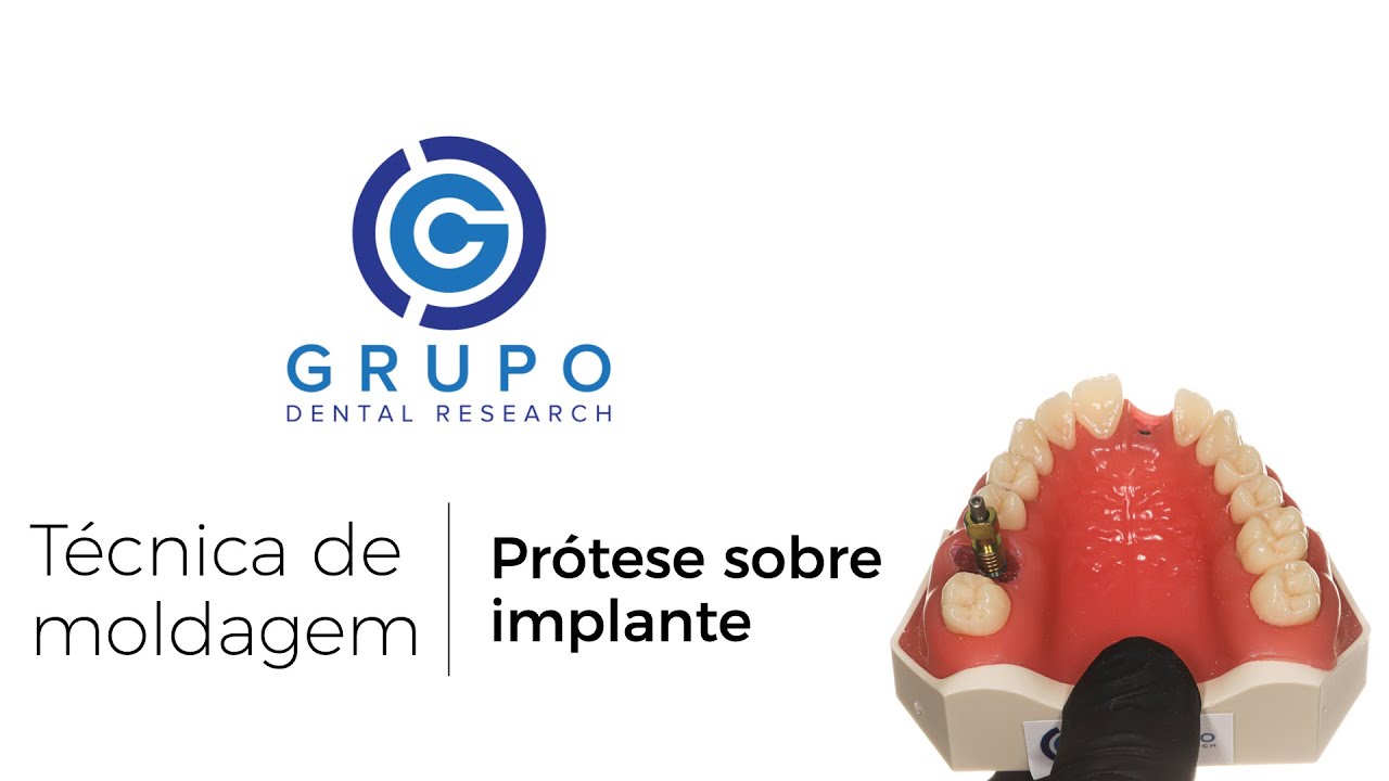 Moldagem de transferência em Prótese sobre implante osseointegrados. Como fazer?