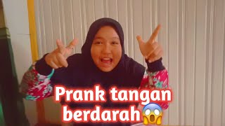 Prank tangan berdarah ke adik aku, dia kaget!!! -Islami Prank