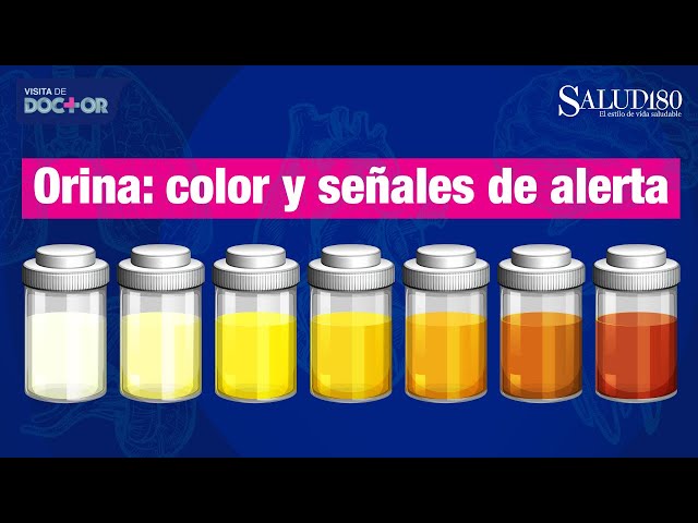 huele mal orina con l carnitina  Notas olor en tu orina? No lo ignores, tu cuerpo podra estar envindote una seal importante.  Deshidratacin, infecciones, azcar elevada o problemas en riones e hgado son solo algunas Causas del mal olor de