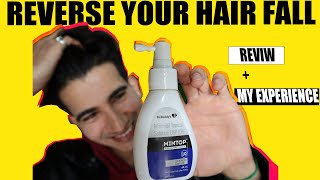 Minoxidil 10% Mintop Review How To Use, Side Effects My Experience Minoxidil Results