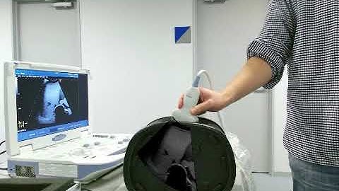 Augmented Reality Echography (Ultrasonography) with Real-time Markerless Probe Tracking