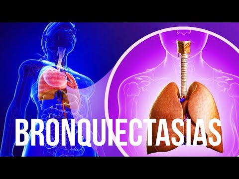 Vídeo: Desarrollo Y Validación Inicial De La Herramienta De Exacerbación Y Síntomas De Bronquiectasias (BEST)