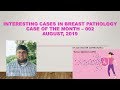 Interesting Cases in Breast Pathology (002) - Case of the Month August, 2019