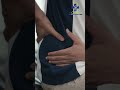 क्या AVN बिना Surgery के ठीक हो सकता है? | Advanced AVN Treatment | Joint Replacement Explained