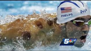 Vermonters use cupping as pain therapy, like Olympians