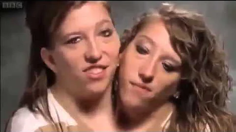 Abby and Brittany Joined for Life Episode 5 BBC Th...