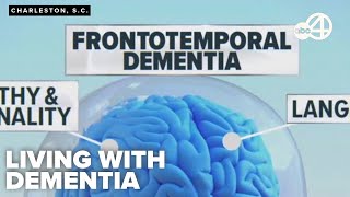 Local doctor talks Bruce Willis' condition, offers advice for families of aging loved ones