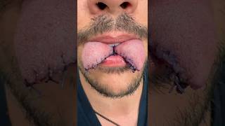 Man Cut His Tongue in Two - Here’s What Happens.