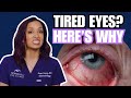 Tired Eyes? What’s Really Causing Them and How to Find Relief Mp3 Song