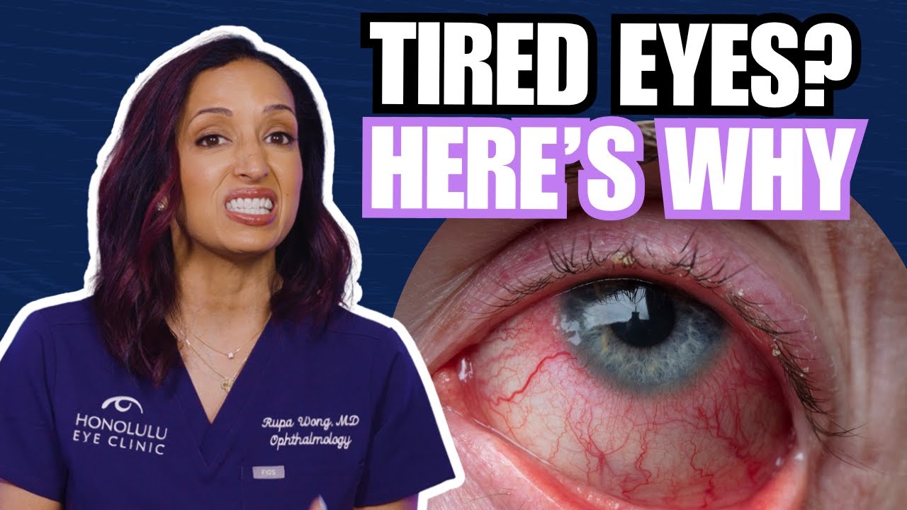 Tired Eyes? What’s Really Causing Them and How to Find Relief