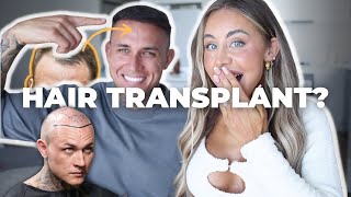 MY FIANCE&#39;S HAIR-TRANSPLANT EXPERIENCE