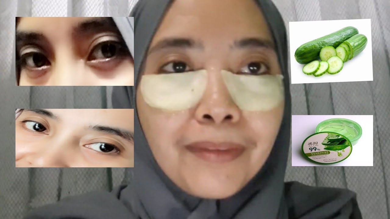 Cara menghilangkan mata panda /bawah mata kehitaman - YouTube