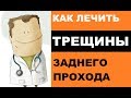 Как лечить трещины заднего прохода?