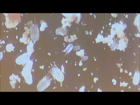 Клещи домашней пыли