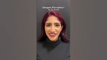 اكثر يوتيوبر مسوين عملية تجميل انف قمر الطائي ونارين بيوتي 
