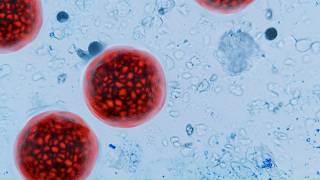 Falmouth woman speaks out after experiencing Cyclospora symptoms but testing negative