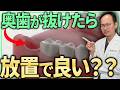 部位別に歯が抜けて放置したらどうなるのかを解説します！現役の歯医者が歯を失った時に起こる口の中の現象をお話しします