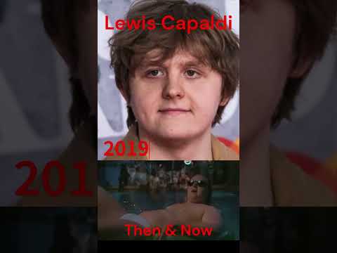 Lewis Capaldi transformation