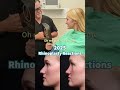 2025 Rhinoplasty Reactions