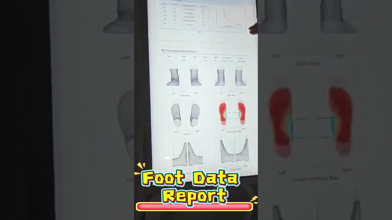 Xianku 3D Foot Scanner Demo