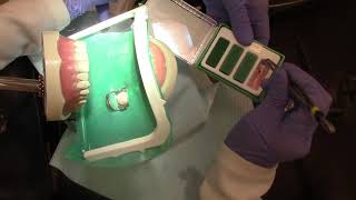 Root Canal Procedure