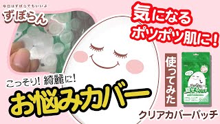 こっそり！綺麗に！お悩みカバー★クリアカバーパッチ使ってみた♪