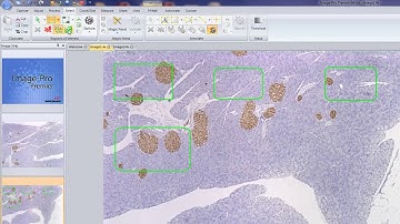 Features Manager Video   Image Pro Premier Software