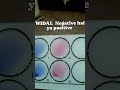 WIDAL Negative hai ya positive #videoshort