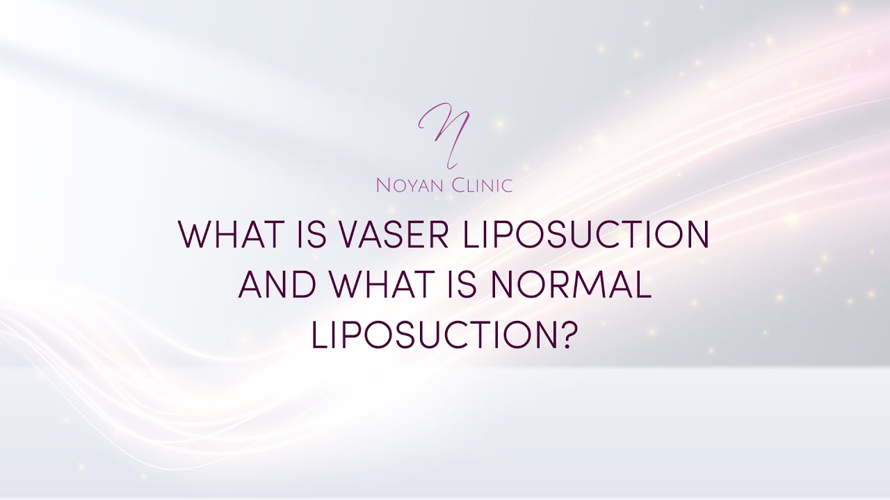 What Is Vaser Liposuction And What Is Normal Liposuction? - YouTube