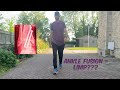 Ankle Fusion: Will I walk with a limp after ankle fusion???