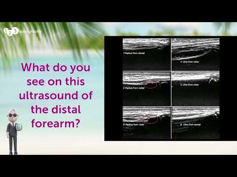 Image of What do you see on this ultrasound of the distal forearm?