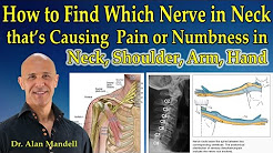 How to Determine Which Nerve in Neck that's Causing Pain or Numbness in Neck, Shoulder, Arm, Hand