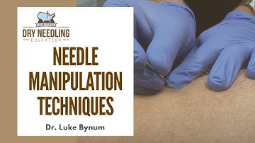 Dry Needling Needle Manipulation Techniques