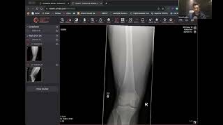 Plain Film X-Ray And Ct Reporting By Dr. Imran Lasker Case 210
