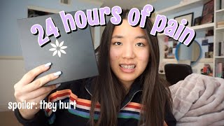 my first 24 hours with invisalign braces | Vanessa Nagoya