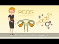 Синдром полікістозних яєчників (СПКЯ)? Fertilovit F PCOS створений саме для підтримки жінок з СПКЯ.