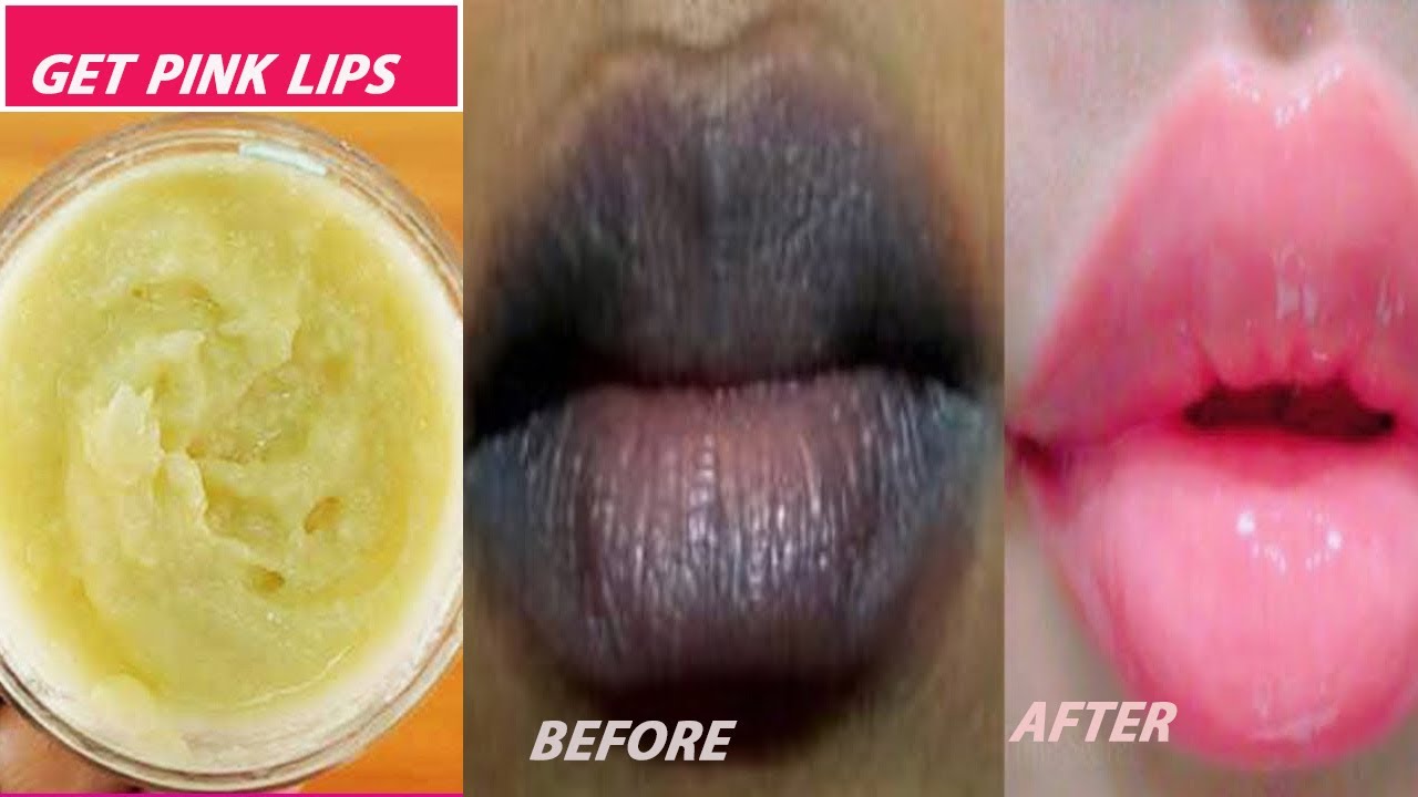 Easy Ways To Make Your Lips Pink NATURALLY In 1 Weeks (Easy And 100