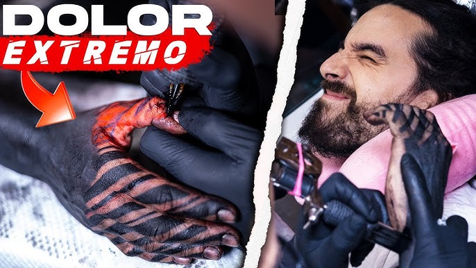 Cómo curar un tatuaje infectado? 5 consejos - Blogs MAPFRE