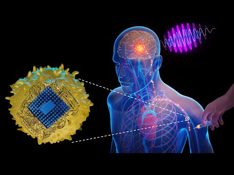 Electronic Brain Implants that Defy the Need for Surgery