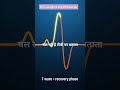 ECG Basics Explained | Simple ECG Animation | Heart Health Shorts#subscribe #shortsfeed #like