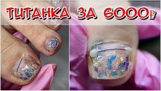 видео: Титанка за 6000! Почему синяк под ногтем? Покрытие на ногти / Гель лак на ногти на ногах картинка: Титанка за 6000! Почему синяк под ногтем? Покрытие на ногти / Гель лак на ногти на ногах