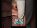 Missing Maxillary Anterior Central Incisors:BASAL? GBR?CONVENTIONAL?